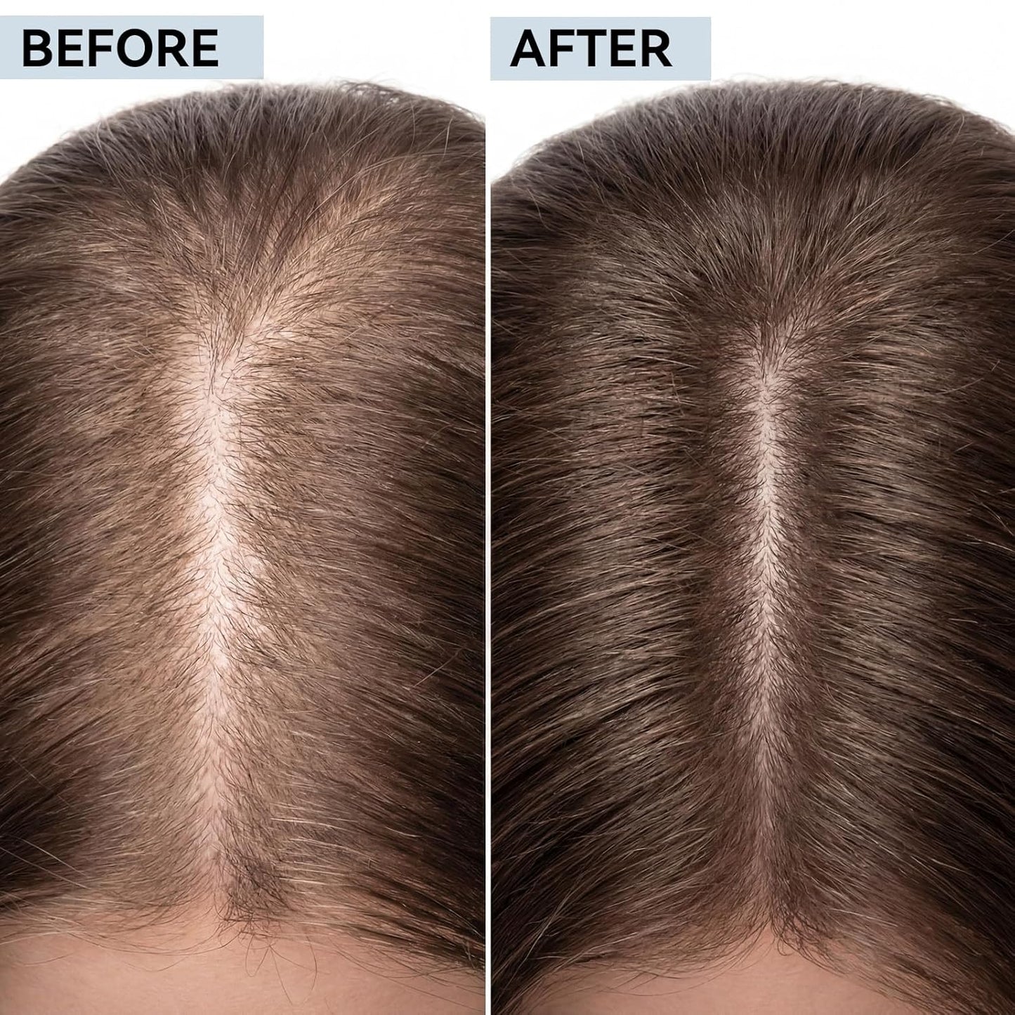 Hair Regrowth System - Multi-Peptide Serum with Copper Peptides & Ginseng for Thicker, Fuller Hair | Unisex