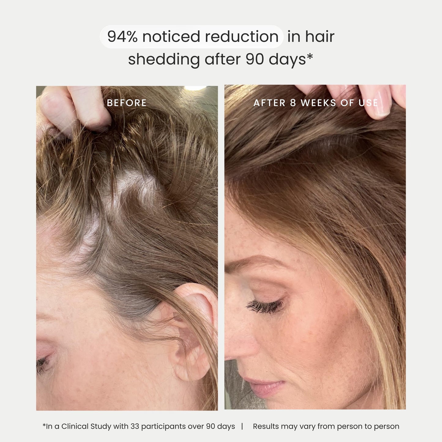 The Spa Dr. Hair Serum - Clean Hair Thickening Serum with Red Clover and Pea Sprout Extracts and Peptides - 1.5 Fl. Oz.