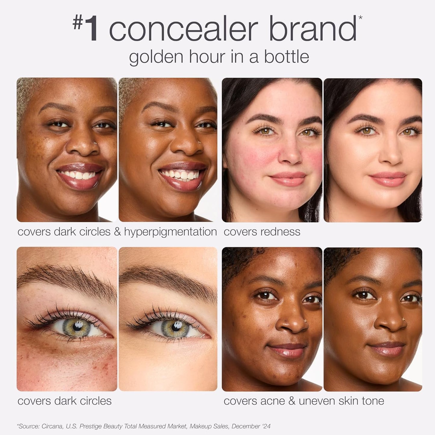 Tarte Shape Tape Radiant Concealer - Medium Coverage for Dark Circles, Fine Lines & Redness | Hydrating & Vegan