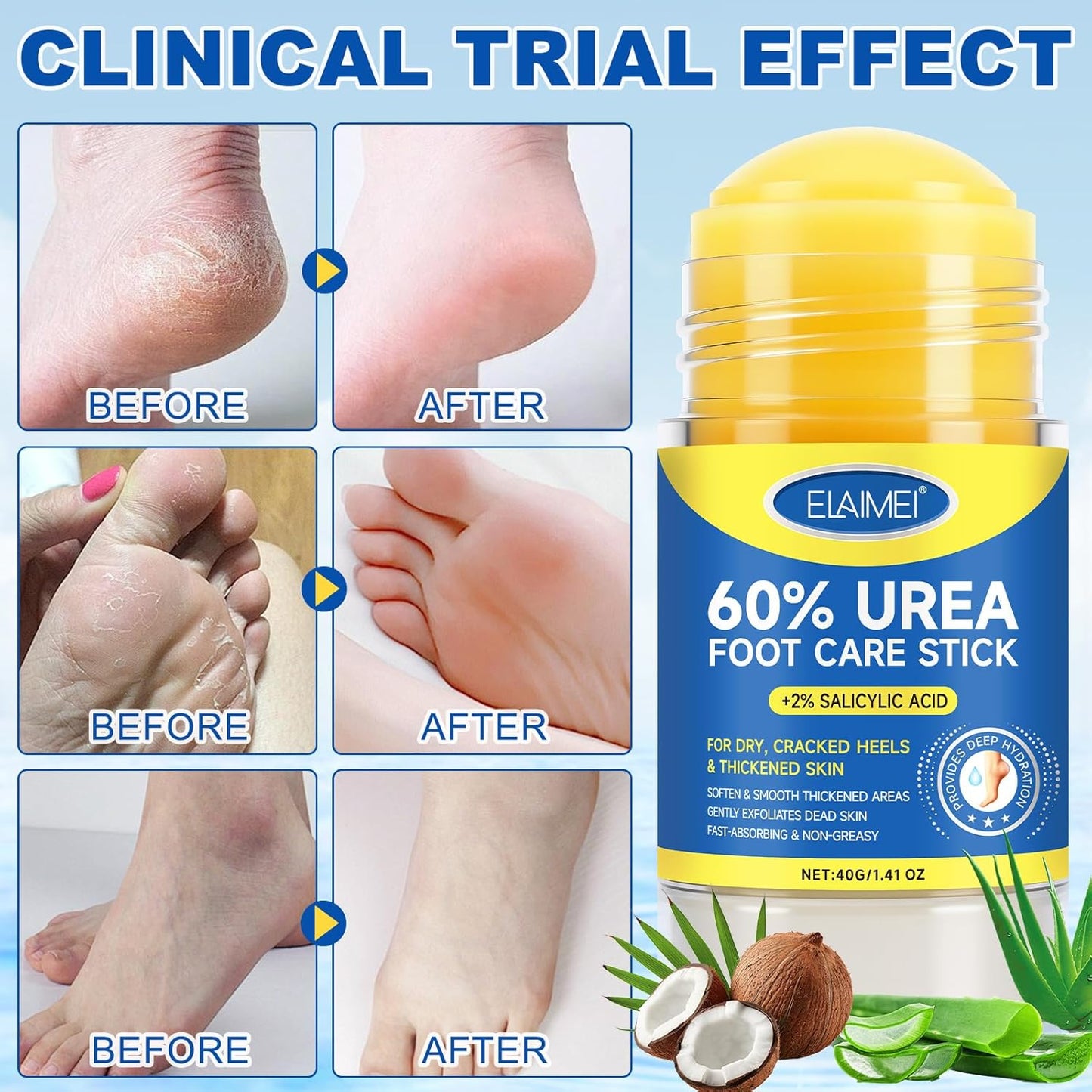 Urea Cream Stick - Exfoliating Foot Balm with 2% Salicylic Acid for Dry Skin | 1.4 oz