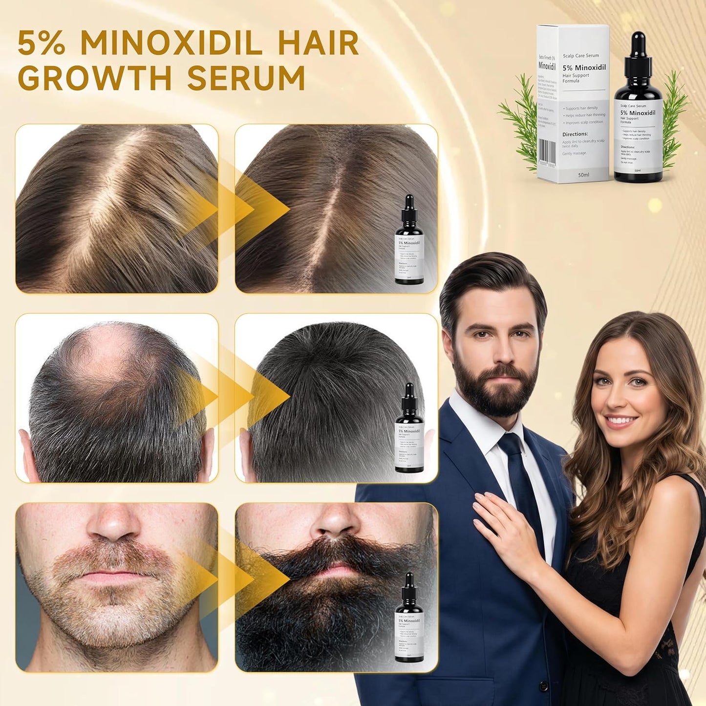Minoxidil Growth Serum for Hair Loss - Supports Regrowth & Beard Growth | Lightweight Scalp Serum with Rosemary Extract, 1.7 fl oz - White