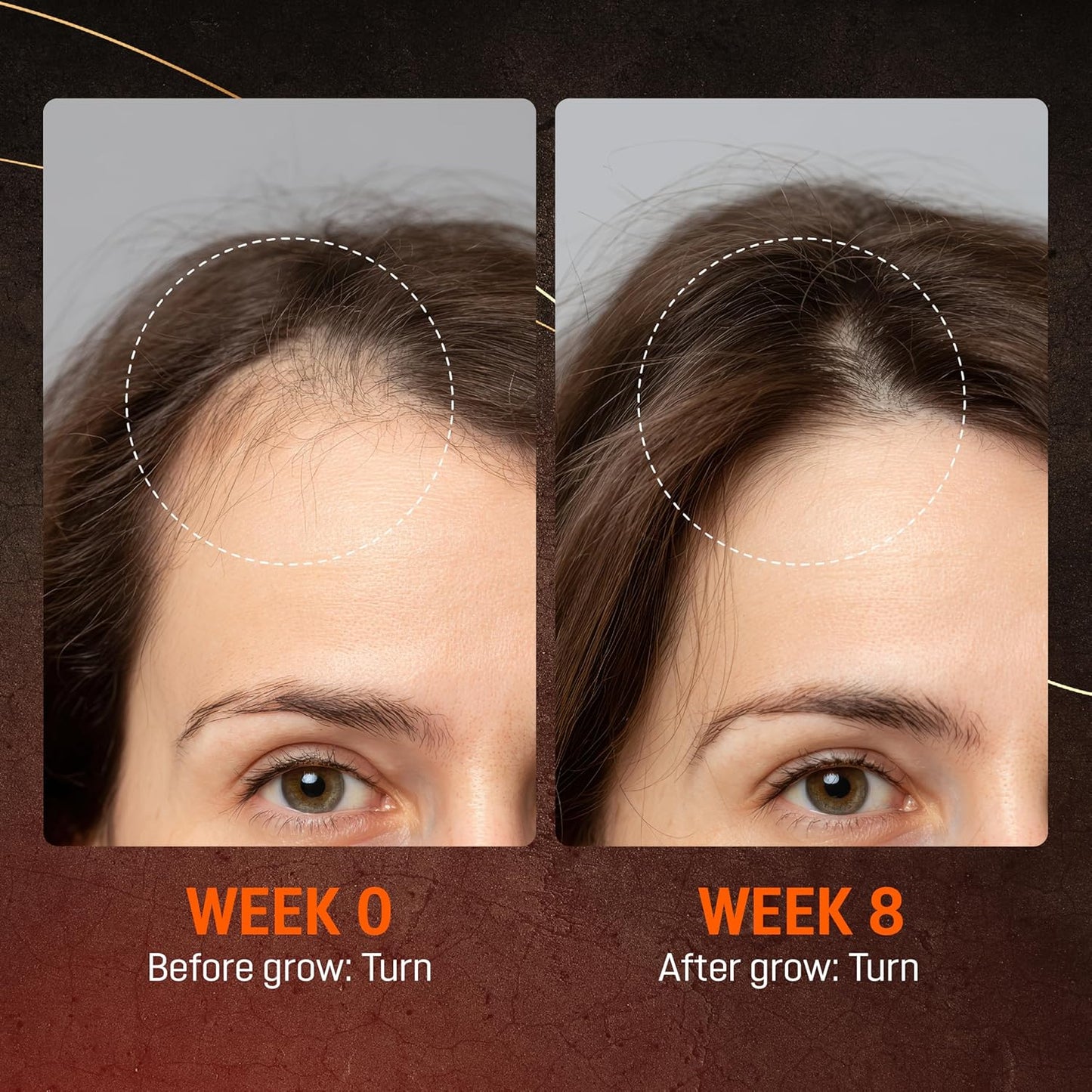 Abera Hair Growth Serum - Natural Regrowth Treatment for Hair & Beard with Biotin & Maca Root | Extra Strength 1.69 fl oz