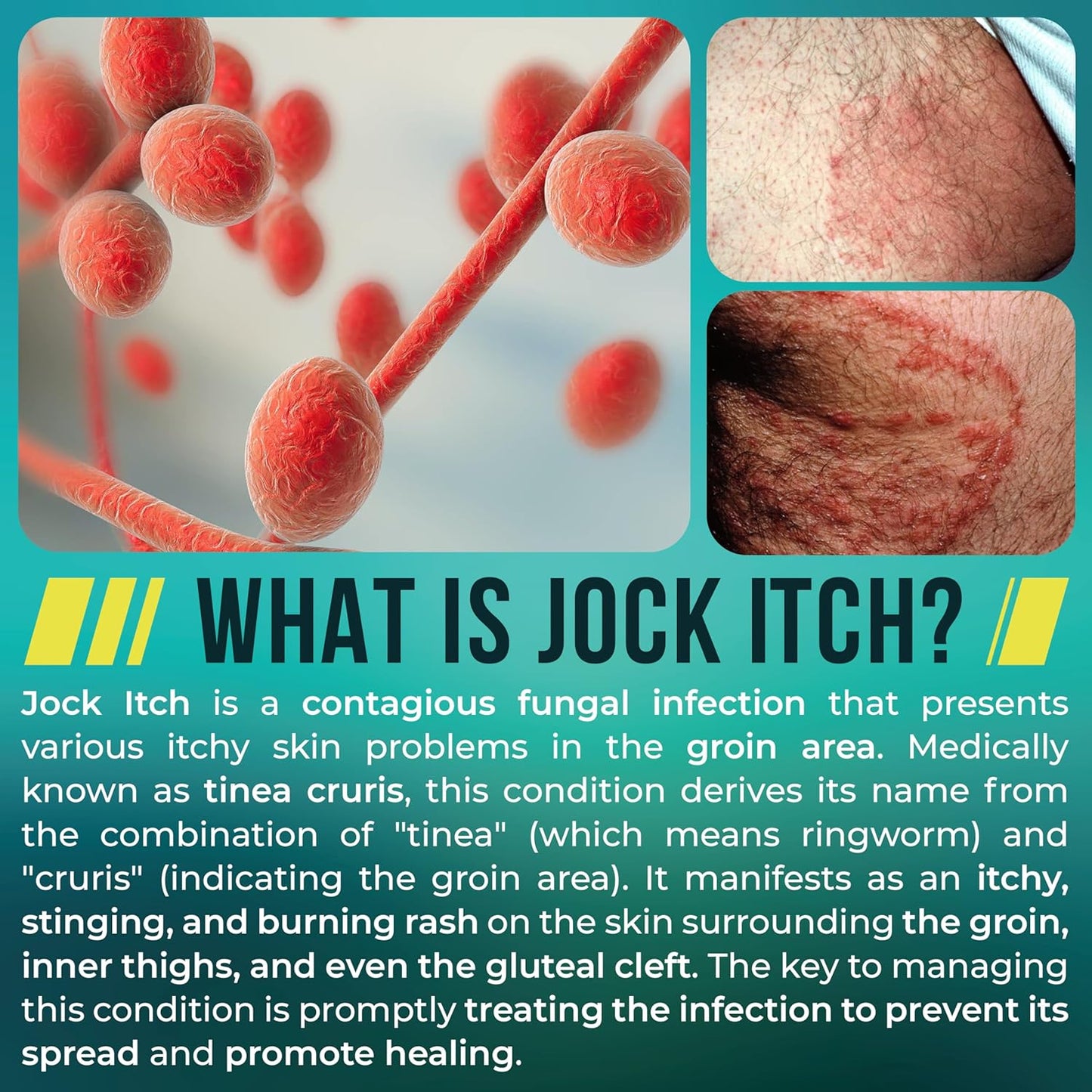 Terramed Jock Itch Treatment Bundle - Spray, Cream & Antifungal Soap for Fast Relief | Odor Control & Deep Exfoliation