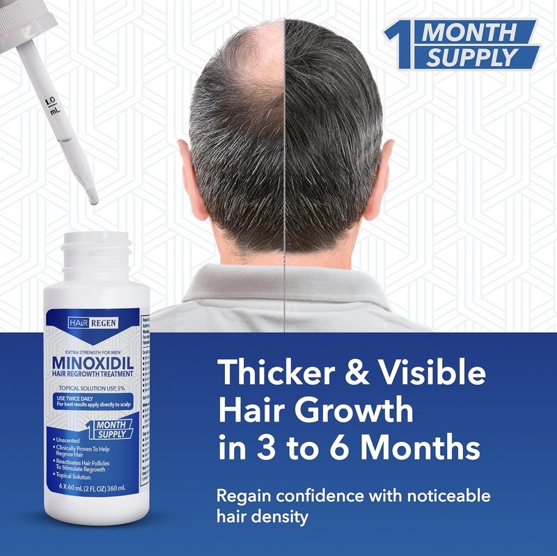 Minoxidil for Men 5% - Advanced Hair Regrowth Treatment - 6-Month Supply Kit for Hair Loss