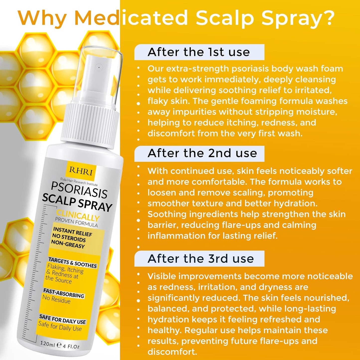 Psoriasis Scalp Spray - Antifungal Treatment for Dandruff, Yeast Infections & Flare-Ups | Soothing Relief for Itchy Scalp