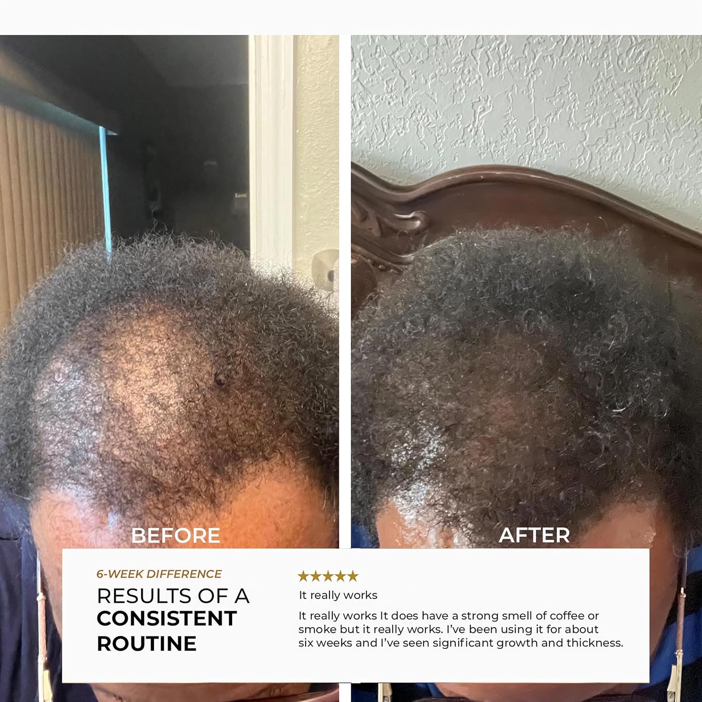 Unrefined Batana Oil - Pure Hair Growth Treatment for Thicker Hair | 100% Raw & Natural, 4oz
