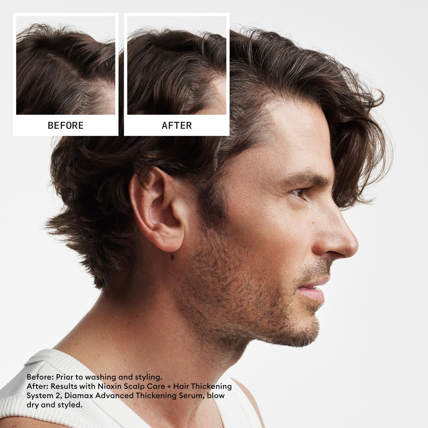 Nioxin Scalp + Hair Thickening System 2 Conditioner | For Natural or Untreated Hair with Progressed Thinning | With Niacinamide and Biotin |10.1 Fl oz.