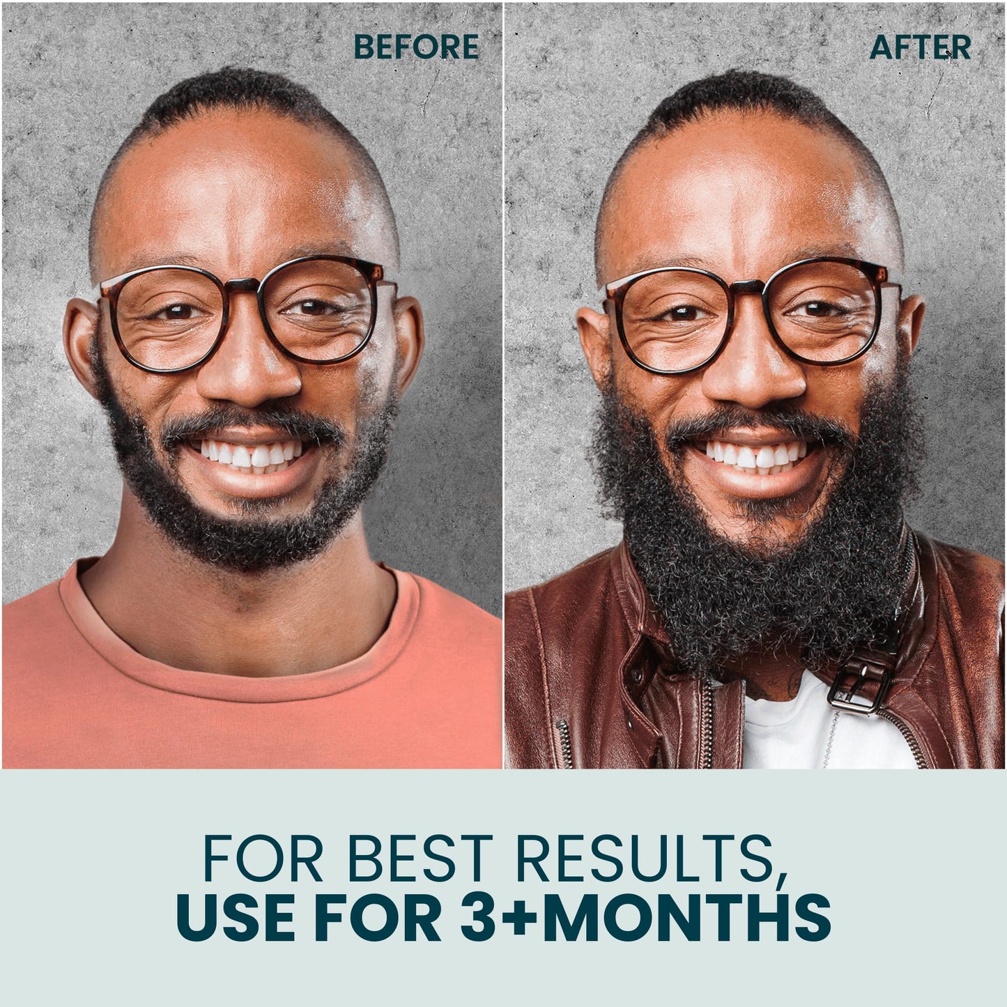 Ouiloe Beard Oil for Dry Skin - Non Comedogenic Beard Oil for Black Men - Safe for Acne Prone, Sensitive Skin - Unscented, Fragrance Free, Lightweight, Non Greasy, Soothing and Natural, 2oz
