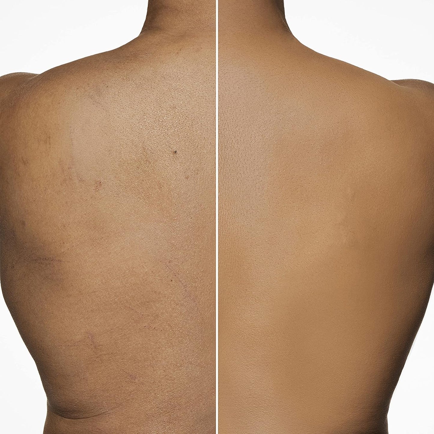 Dermablend Leg & Body Makeup Foundation - SPF 25, Full Coverage, Waterproof