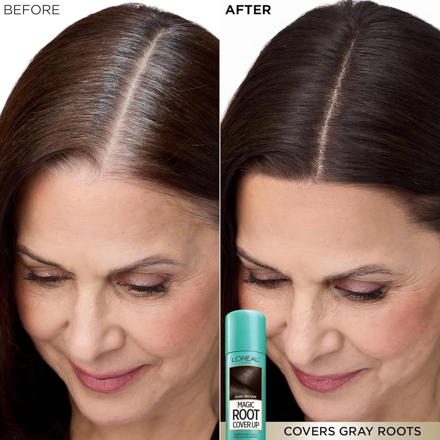 L'Oreal Paris Magic Root Cover Up - Dark Brown Gray Hair Spray | 100% Coverage, Ammonia-Free, 2 oz