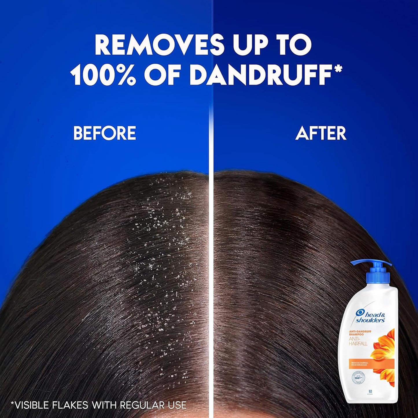 Head & Shoulders Anti Hair Fall Shampoo - Dandruff Relief & Scalp Repair | 22 oz Pump Bottles (2-Pack)