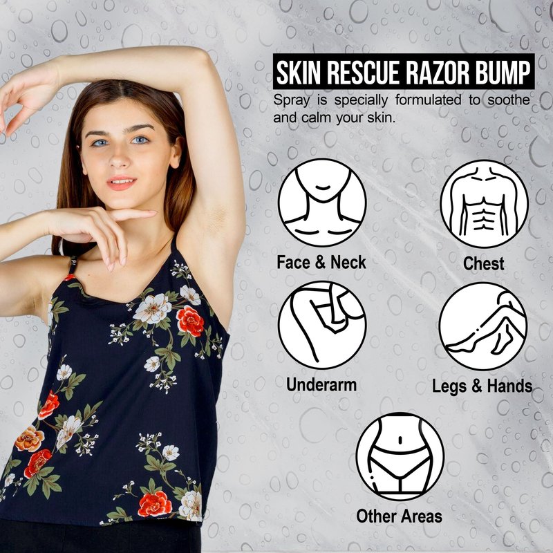 Xotics Skin Rescue Razor Bump 2oz - All Natural Barber Aftershave Razor Burn Treatment for Men/Women - All Natural Ingredients