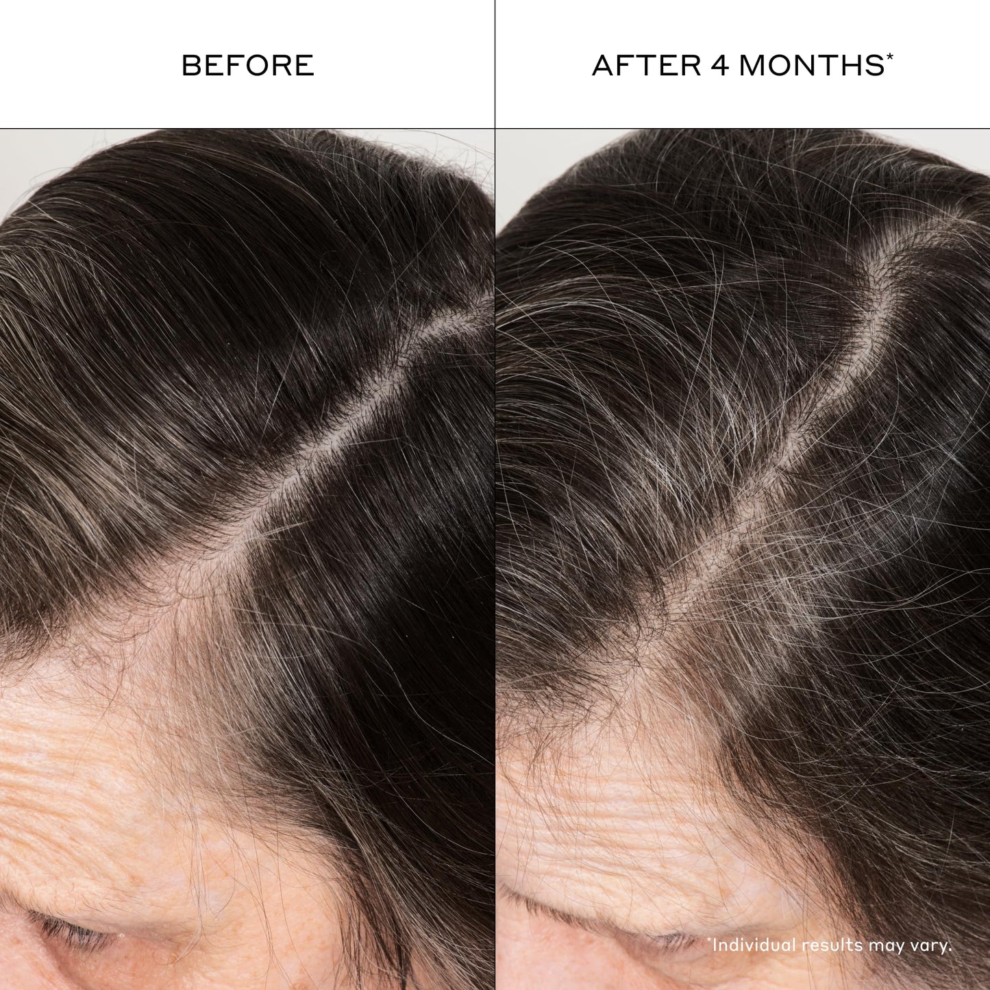 Zenagen Densifying Hair Serum | Boosts Hair Density 1.7 Fl Oz