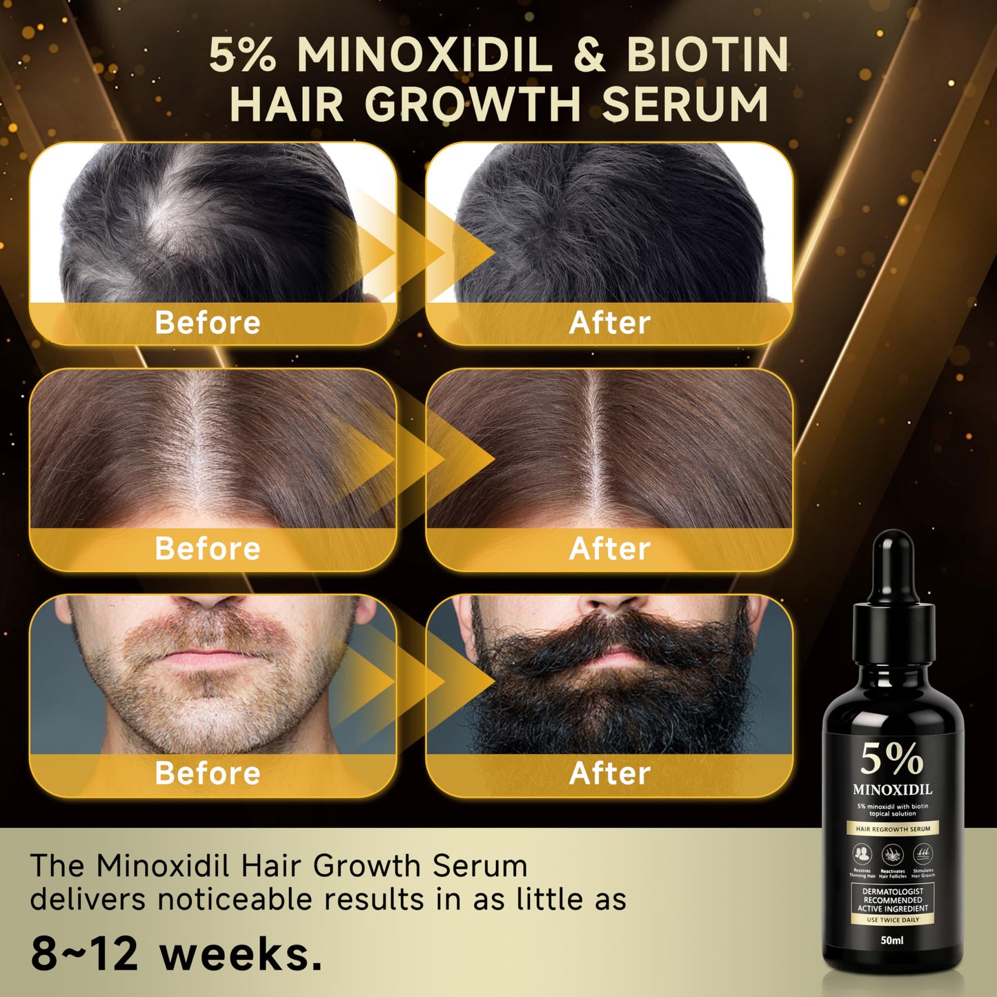 5% Minoxidil Hair Growth Biotin Serum for Men & Women, Minoxidil Hair Topical Solution for Beard Growth, Hair Loss Treatment, Biotin Hair Serum, Prevents Hair Loss and Thinning, 50ml/1.7oz