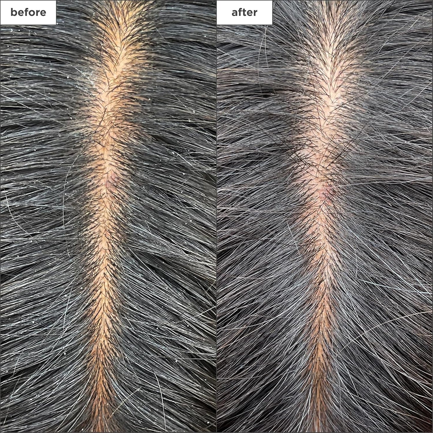 Briogeo Scalp Revival Charcoal Scalp Mask - Detoxifying Hydration Treatment | 6 oz | Vegan & Cruelty-Free
