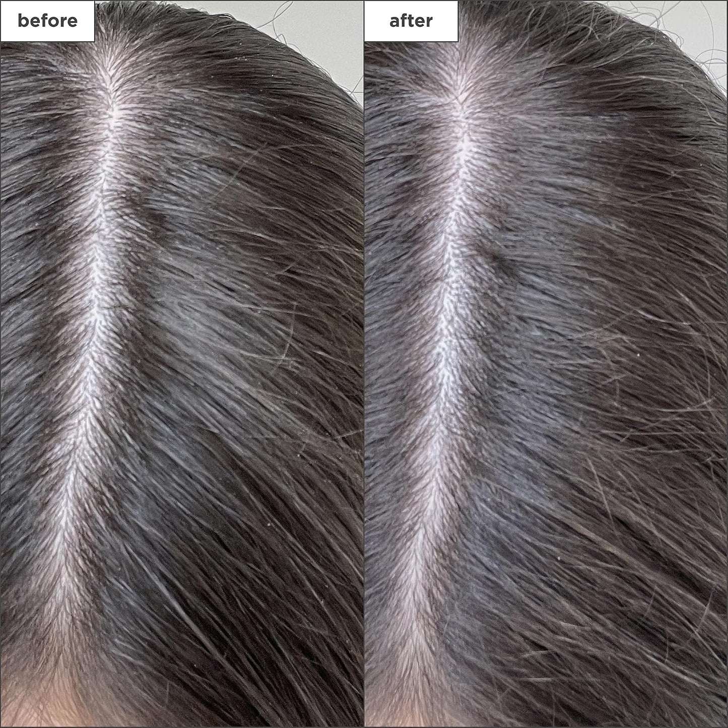 Briogeo Scalp Revival Charcoal Dry Shampoo - Detoxifying Non-Aerosol Powder for Oily Roots | Vegan, 1.7 oz.