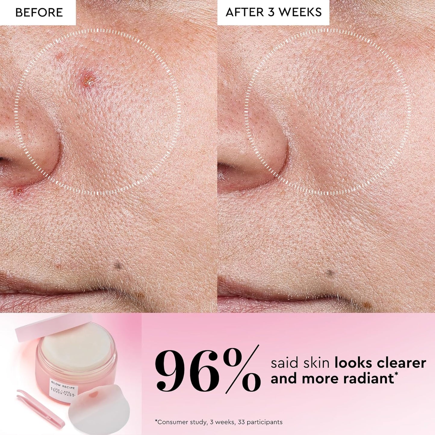 Glow Recipe LHA + AHA Toner Pads | Korean Exfoliating Face Toner - Hydrating & Pore Minimizing - 60 Gentle Pads