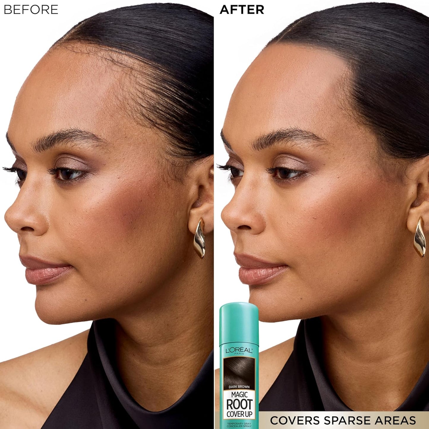 L'Oreal Paris Magic Root Cover Up - Dark Brown Gray Hair Spray | 100% Coverage, Ammonia-Free, 2 oz