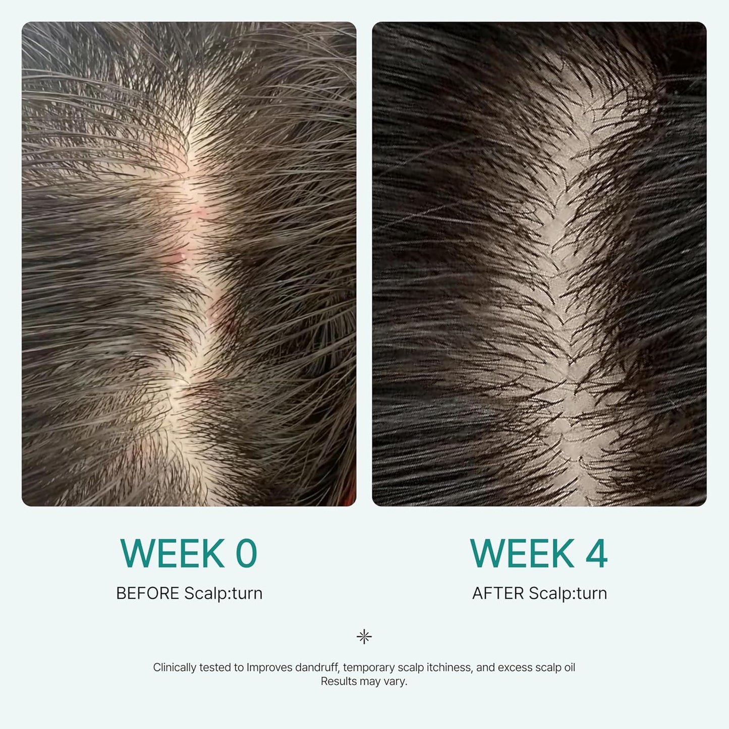 Lilyeve Scalp Serum - Cica PDRN Treatment for Itchy Scalp Relief & Hydration | 1.01 fl. oz.