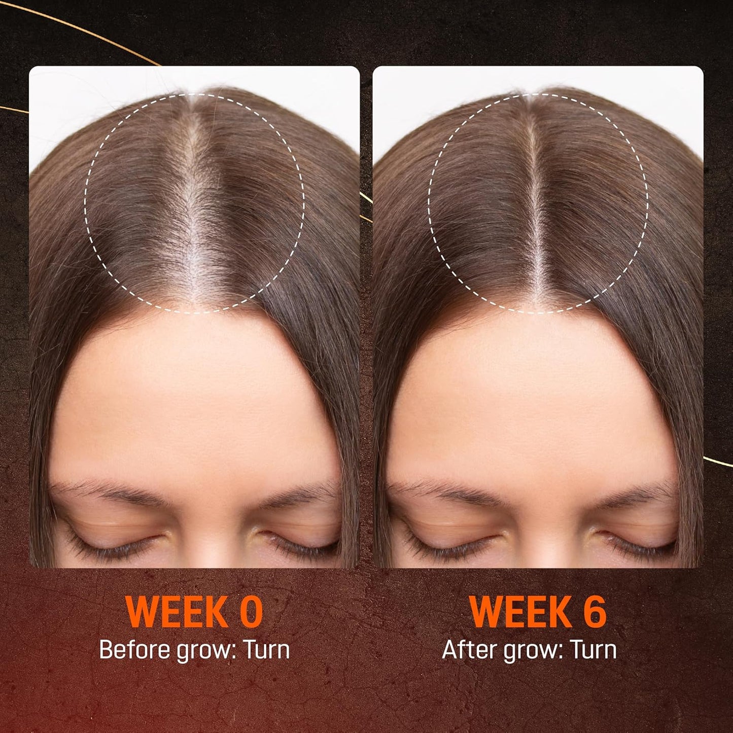 Abera Hair Growth Serum - Natural Regrowth Treatment for Hair & Beard with Biotin & Maca Root | Extra Strength 1.69 fl oz