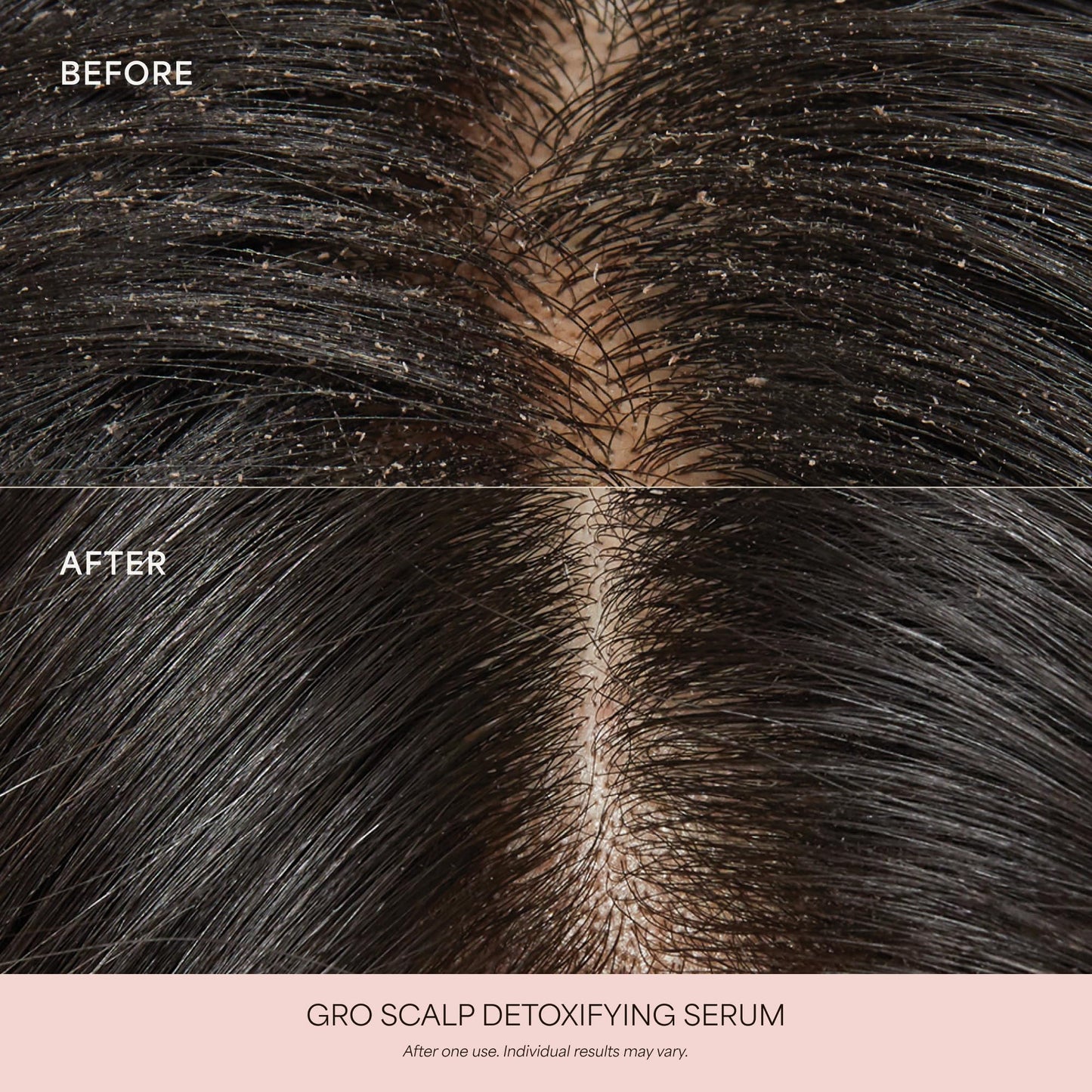 VEGAMOUR GRO Scalp Detoxifying Serum, Scalp Serum with Zinc PCA Removes Buildup & Soothes Scalp, Natural Citrus Scent, 2 fl. oz.