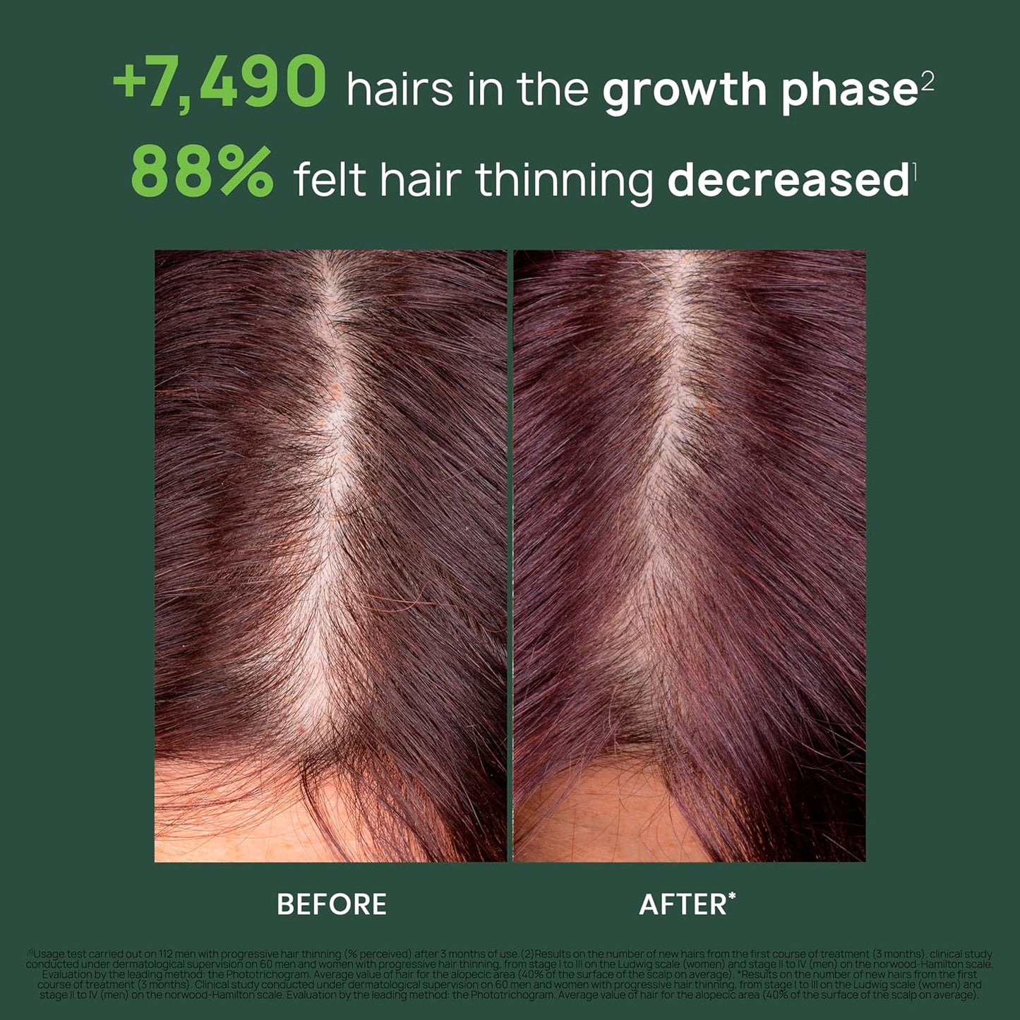 Rene Furterer Triphasic Serum for Hormonal Thinning Hair - Drug-Free Leave-In Treatment | 30-Day Supply, 8 ct.