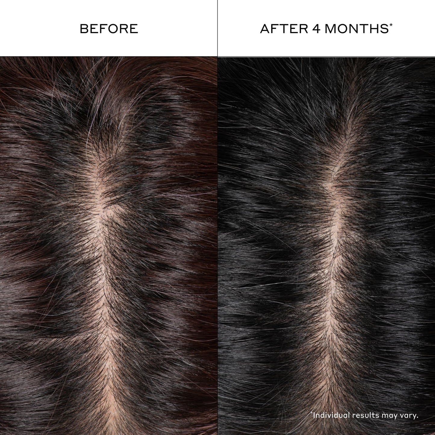 Zenagen Densifying Hair Serum | Boosts Hair Density 1.7 Fl Oz