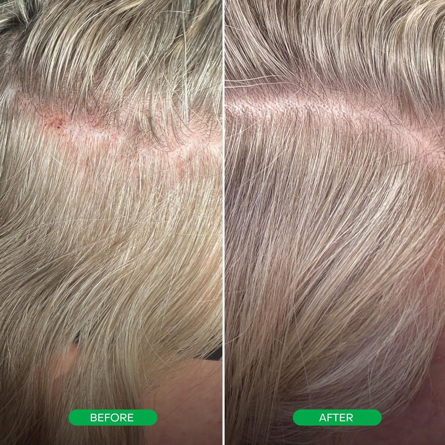 Everist Multi-Peptide Scalp Serum - Peptides & Caffeine for Thicker Hair | 60ml
