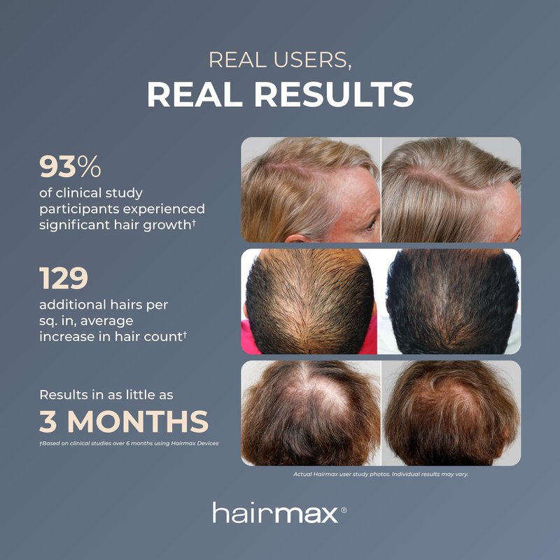 Hairmax Ultima 9 Classic LaserComb -(FDA Cleared) Laser Hair Regrowth Treatment Device for Men & Women - Reverses Thinning Hair Loss - Red Light Therapy to Stimulate Hair Growth - Cordless Design